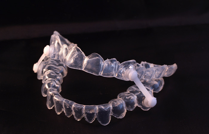 口腔内装置(OA)の製作